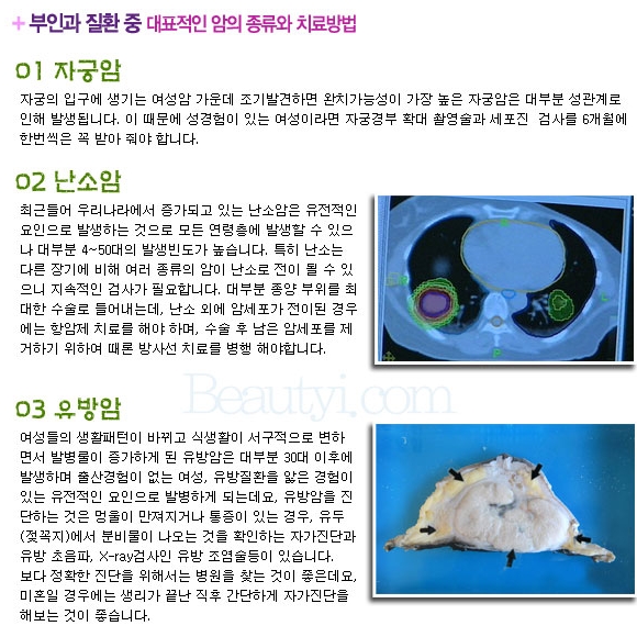 여자라면 고민해봤을 산부인과 질환!