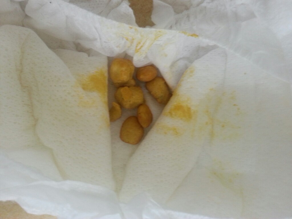 신생아 변 사진좀 봐주세용~