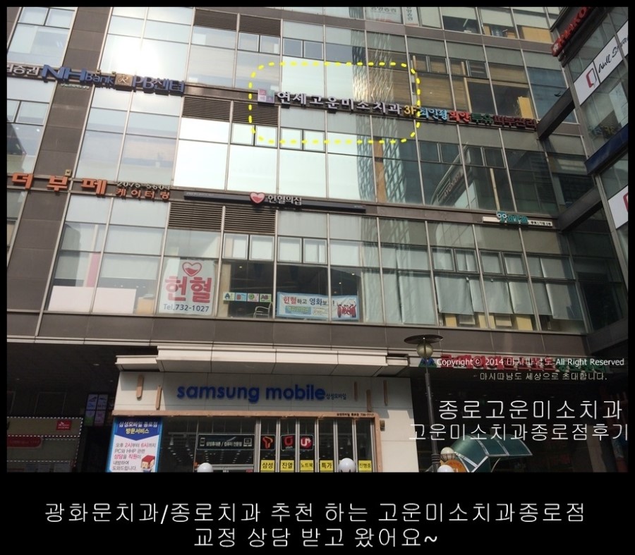 광화문치과/종로치과 추천 하는 고운미소치과종로점 교정 상담 받고 왔어요~
