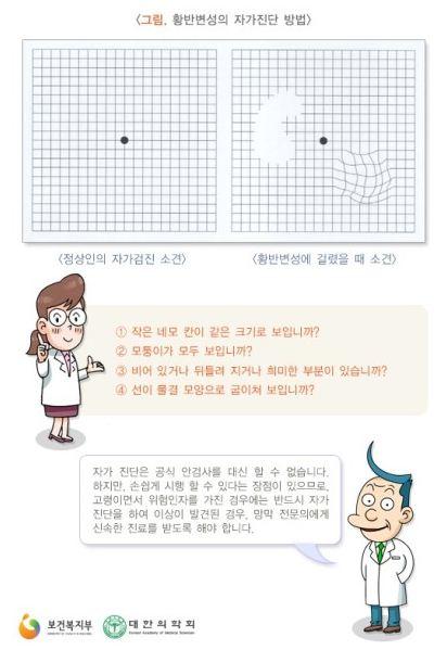 황반변성 환자 급증